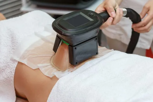 Image of person having fat freezing treatment to help weight gain East Retford