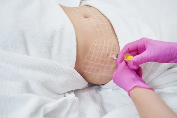 image of fat dissolving injections on love handles to help combat weight gain East Retford
