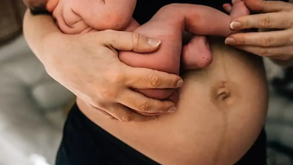Why Is My Stomach Still Big After Pregnancy East Retford?