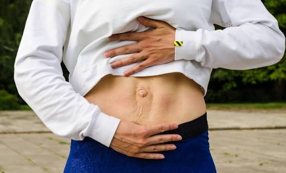 When Could Diastasis Recti Be the Missing Piece of the Puzzle East Retford?